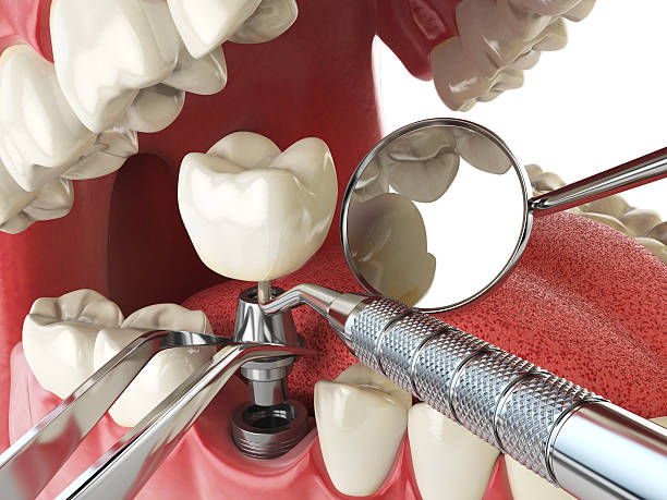 Best 24-Hour Emergency Dentist in Marine City, MI
